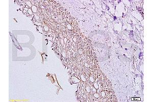 Formalin-fixed and paraffin embedded rat ovary tissue labeled with Anti-Inhibin Alpha Polyclonal Antibody, Unconjugated (ABIN736656) at 1:200, followed by conjugation to the secondary antibody and DAB staining (Inhibin alpha Antikörper  (AA 301-366))