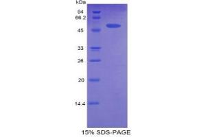 SDS-PAGE (SDS) image for Carnitine Palmitoyltransferase 1A (Liver) (CPT1A) (AA 572-773) protein (His tag,GST tag) (ABIN1877948)