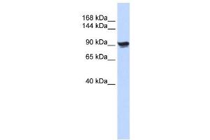 Alpha Actinin 1 antibody used at 1 ug/ml to detect target protein. (ACTN1 Antikörper  (N-Term))