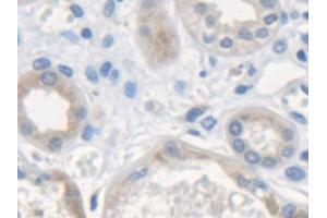 Detection of ME2 in Human Kidney Tissue using Polyclonal Antibody to Malic Enzyme 2, NADP+ Dependent, Mitochondrial (ME2) (Malic Enzyme 2, NADP+ Dependent, Mitochondrial (AA 220-426) Antikörper)