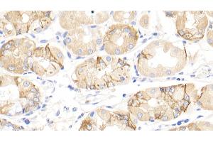 Detection of INHbA in Human Stomach Tissue using Polyclonal Antibody to Inhibin Beta A (INHbA) (INHBA Antikörper  (AA 311-426))