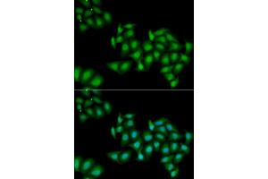 Immunofluorescence analysis of HeLa cells using DDX1 antibody (ABIN5973950). (DDX1 Antikörper)