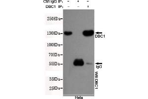 Immunoprecipitation analysis of Hela cell lysates using DBC1 mouse mAb. (DBC1 Antikörper)