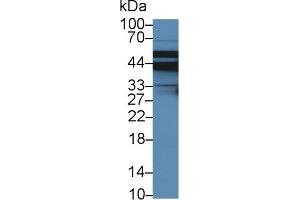 Detection of SLC9A3R2 in Porcine Liver lysate using Polyclonal Antibody to Sodium Hydrogen Exchange Regulatory Cofactor 2 (SLC9A3R2) (Sodium Hydrogen Exchange Regulatory Cofactor 2 (AA 56-337) Antikörper)