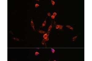 Immunofluorescence analysis of NIH/3T3 cells using PIK3CA Polyclonal Antibody at dilution of 1:100. (PIK3CA Antikörper)