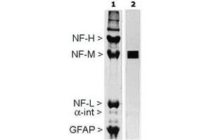 Rat spinal cord homogenate showing the major intermediate filament proteins of the nervous system. (NEFM Antikörper  (C-Term))