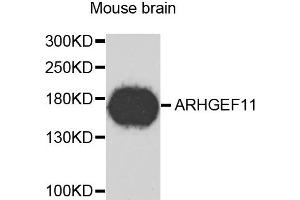 Western blot analysis of extracts of mouse brain, using ARHGEF11 antibody. (ARHGEF11 Antikörper)