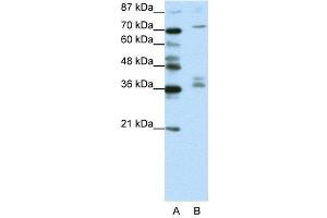 WB Suggested Anti-AKAP9  Antibody Titration: 1. (AKAP9 Antikörper  (N-Term))