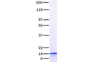 Validation with Western Blot (CCL25 Protein (Transcript Variant 1))