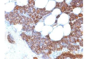 Formalin-fixed, paraffin-embedded human Parathyroid stained with PTH Mouse Monoclonal Antibody (SPM604). (PTH Antikörper  (AA 1-34))