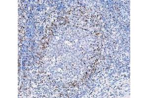 IHC analysis of ADK using anti-ADK antibody (ABIN4886430). (ADK Antikörper  (AA 165-351))