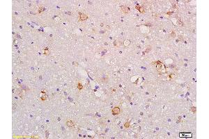 Formalin-fixed and paraffin embedded rat brain labeled with Anti-Gas1 Polyclonal Antibody, Unconjugated (ABIN872751) at 1:200 followed by conjugation to the secondary antibody and DAB staining. (GAS1 Antikörper  (AA 101-200))