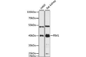 Western blot analysis of extracts of various cell lines, using PIM1 antibody (ABIN6128456, ABIN6145654, ABIN6145656 and ABIN6218499) at 1:3000 dilution. (PIM1 Antikörper  (AA 1-313))