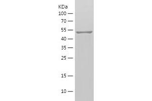 Western Blotting (WB) image for Matrix Metalloproteinase 2 (MMP2) (AA 424-660) protein (His-IF2DI Tag) (ABIN7123862) (MMP2 Protein (AA 424-660) (His-IF2DI Tag))