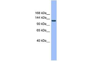 WB Suggested Anti-EVI1 Antibody Titration: 0.