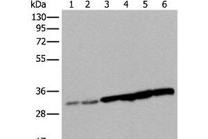 Western blot analysis of 293T cell Hela cell HEPG2 cell and A549 cell lysates using SNRPA Polyclonal Antibody at dilution of 1:250 (SNRPA1 Antikörper)