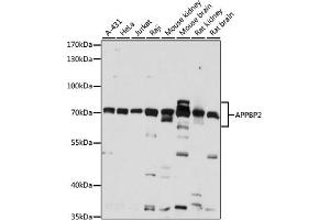 Western blot analysis of extracts of various cell lines, using  antibody (ABIN7265579) at 1:1000 dilution. (APPBP2 Antikörper  (AA 386-585))