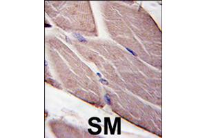 Formalin-fixed and paraffin-embedded human skeletal muscle tissue reacted with PDK4 polyclonal antibody  , which was peroxidase-conjugated to the secondary antibody, followed by DAB staining .