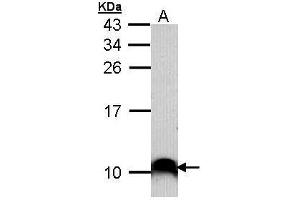 WB Image Sample (30 ug of whole cell lysate) A: A431 , 15% SDS PAGE antibody diluted at 1:1000 (COX7B2 Antikörper)