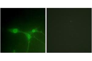 Immunofluorescence analysis of NIH-3T3 cells, using Breast Tumor Kinase (Ab-447) Antibody.