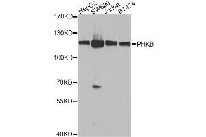 Western blot analysis of extracts of various cell lines, using PHKB antibody (ABIN5974480) at 1/1000 dilution. (PHKB Antikörper)