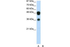 Western Blotting (WB) image for anti-Forkhead Box A1 (FOXA1) antibody (ABIN2460520) (FOXA1 Antikörper)
