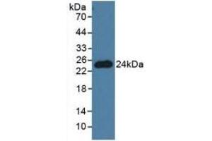 Detection of PNOC in Mouse Brain Tissue using Polyclonal Antibody to Pronociceptin (PNOC) (Pronociceptin (AA 12-187) Antikörper)