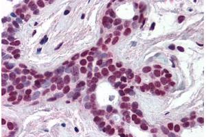 Human Breast (formalin-fixed, paraffin-embedded) stained with CUL3 antibody ABIN218508 at 1:500 followed by biotinylated goat anti-rabbit IgG secondary antibody ABIN481713, alkaline phosphatase-streptavidin and chromogen. (Cullin 3 Antikörper  (N-Term))