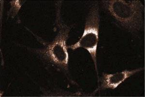 Immunoflourescent staining on WI-38 cells. (RAB5 Antikörper  (AA 1-215))