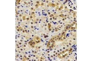 Immunohistochemical analysis of DDX1 staining in mouse kidney formalin fixed paraffin embedded tissue section.