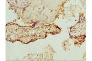 Immunohistochemistry of paraffin-embedded human placenta tissue using ABIN7176144 at dilution of 1:100 (ZNF195 Antikörper  (AA 1-250))