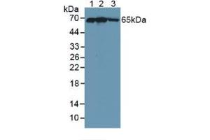 Western blot analysis of (1) Human 293T Cells, (2) Human HepG2 Cells and (3) Human Placenta Tissue. (KEAP1 Antikörper  (AA 327-624))