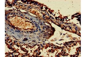 Immunohistochemistry of paraffin-embedded human lung tissue using ABIN7155188 at dilution of 1:100 (FCER1G Antikörper  (AA 19-86))