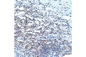 Immunohistochemistry (IHC) image for anti-Chromodomain Helicase DNA Binding Protein 3 (CHD3) antibody (ABIN7266363)