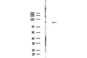 anti-RAD54-Like (RAD54L) (C-Term) antibody