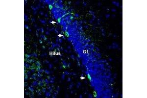 Expression of Zinc transporter ZIP8 in rat hippocampusImmunohistochemical staining of perfusion-fixed frozen rat brain sections with Anti-ZIP8 (SLC39A8) (extracellular) Antibody (ABIN7043726, ABIN7045350 and ABIN7045351), (1:200), followed by goat-anti-rabbit-AlexaFluor-488. (Solute Carrier Family 39 (Zinc Transporter), Member 8 (SLC39A8) Peptid)