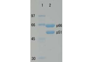 SDS-PAGE (SDS) image for HIV-1 Reverse Transcriptase (HIV1RT) (Active) protein (ABIN2452197)