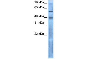 LEFTY2 antibody used at 1 ug/ml to detect target protein. (LEFTY2 Antikörper  (N-Term))