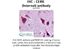 Image no. 1 for anti-Ceramide Kinase (CERK) (Internal Region) antibody (ABIN1733019) (CERK Antikörper  (Internal Region))
