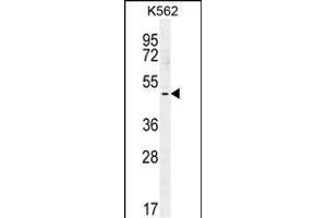 T-Box 6 Antikörper  (C-Term)