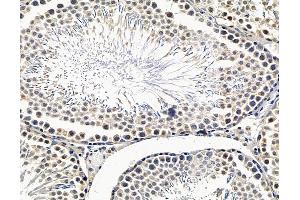 ABIN7096518 and ABIN7100582 at 1/100 staining rat testis tissue by IHC-P. (OSBPL11 Antikörper)
