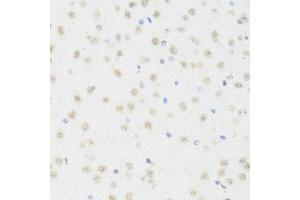 Immunohistochemistry (IHC) image for anti-DEAD (Asp-Glu-Ala-Asp) Box Polypeptide 50 (DDX50) (AA 1-135) antibody (ABIN6139509)