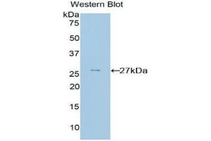 Western blot analysis of the recombinant protein. (PRNP Antikörper  (AA 23-230))