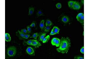 Immunofluorescent analysis of MCF-7 cells using ABIN7151978 at dilution of 1:100 and Alexa Fluor 488-congugated AffiniPure Goat Anti-Rabbit IgG(H+L) (TMEM93 Antikörper  (AA 2-47))