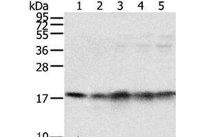 Western Blot analysis of Mouse brain and heart tissue, Jurkat, K562 and hela cell using TAF11 Polyclonal Antibody at dilution of 1:800 (TAF11 Antikörper)