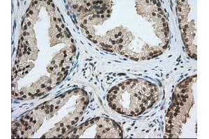 Immunohistochemical staining of paraffin-embedded Human liver tissue using anti-PDE4A mouse monoclonal antibody. (PDE4A Antikörper)