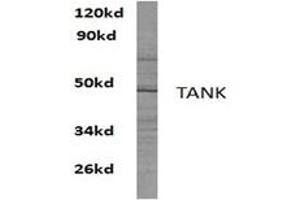 Image no. 1 for anti-TRAF Family Member-Associated NFKB Activator (TANK) antibody (ABIN272299) (TANK Antikörper)