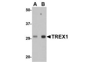 Image no. 1 for anti-three Prime Repair Exonuclease 1 (TREX1) (Internal Region) antibody (ABIN341718) (TREX1 Antikörper  (Internal Region))