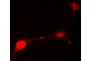 Immunofluorescent analysis of Parkin staining in HepG2 cells. (Parkin Antikörper  (N-Term))