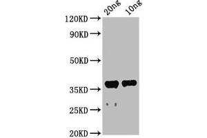 Western Blot Positive WB detected in Recombinant protein All lanes: ache antibody at 2. (Acetylcholinesterase Antikörper  (AA 37-155))